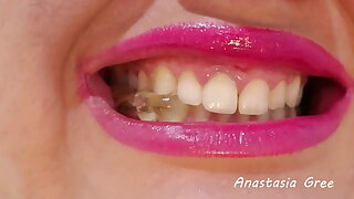 teeth (preview) Model Anastasia Gree